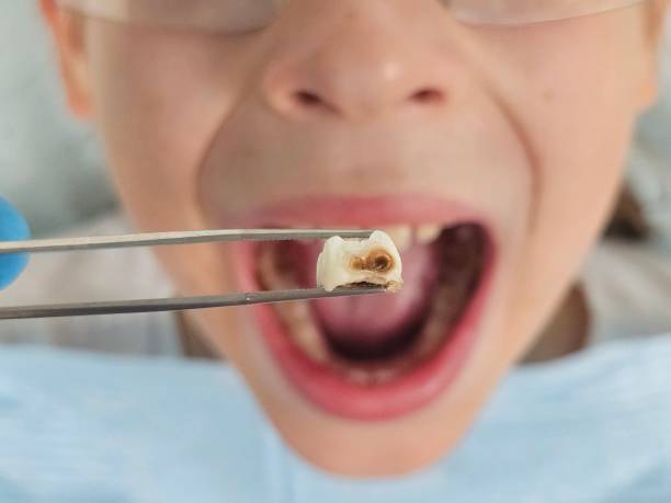 Best Emergency Dental Care for Trauma or Injury in Batesville, AR